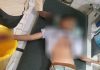 blast in tv remote control in dang 9 year old boy injured